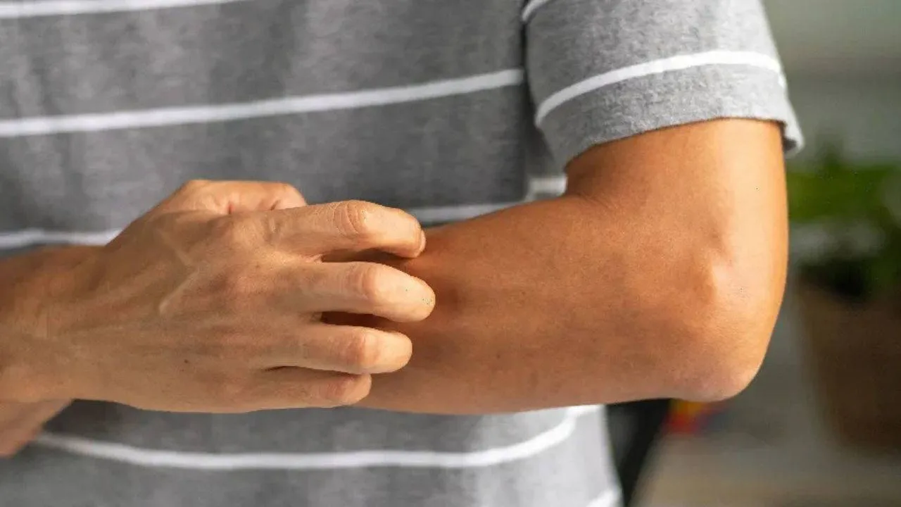 Vücuttaki o kaşıntıyı hafife almayın: Onkologlar uyardı, 4 farklı kanserin habercisi olabilir