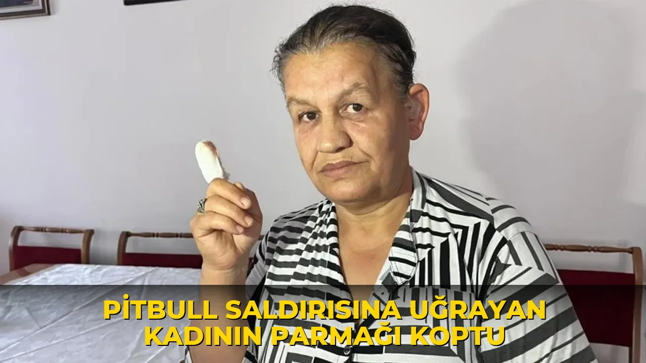 Pitbull saldırısına uğrayan kadının parmağı koptu