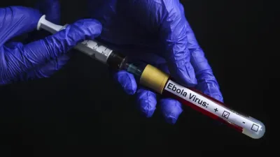 DSÖ’den ebola salgınıyla ilgili çarpıcı açıklama