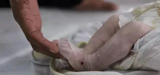 18 aylık bebek kalbi atmasına rağmen morgda bırakıldı!