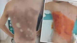İstanbul'da korkunç olay; 12 yaşındaki çocuğu arka mahalleye götürüp yaktılar